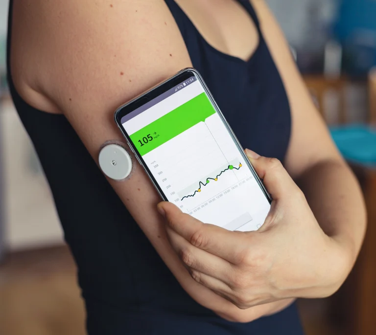 Continuous Glucose Monitoring (CGM) Devices