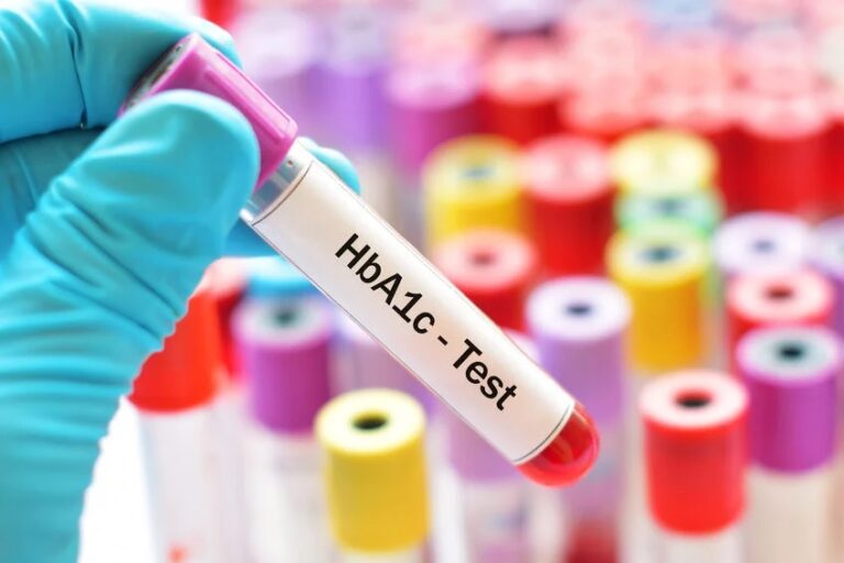 What is the A1C diabetes test?