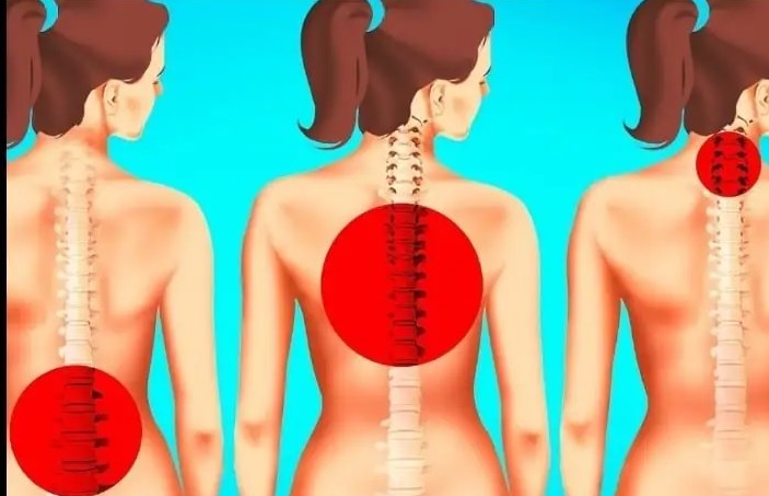 How to Improve Posture and Relieve Back Pain