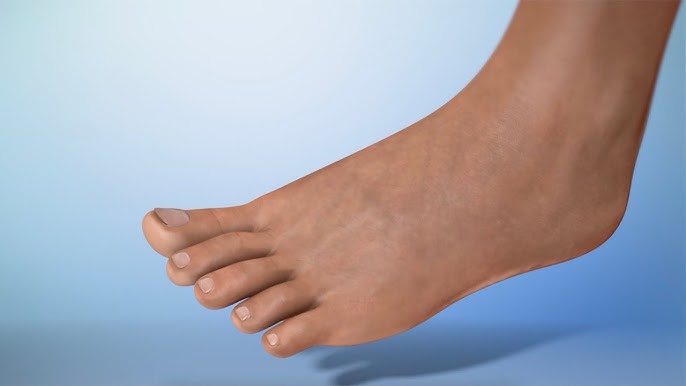 Treating fluid retention, swelling and excess weight!