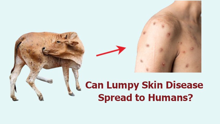 Lumpy Skin Disease (LSD) is it Contagious?