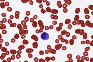 High leukocyte levels