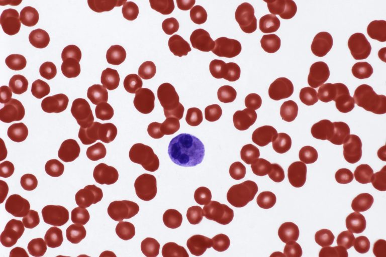 The main causes of high leukocyte levels and efforts to prevent them with a healthy lifestyle